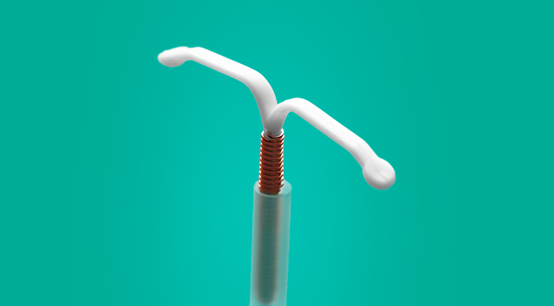DIU mirena tem efeitos colaterais? Entenda! - Clinifemina